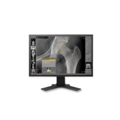 dicomPACS® Prosthesis Documentation Module
