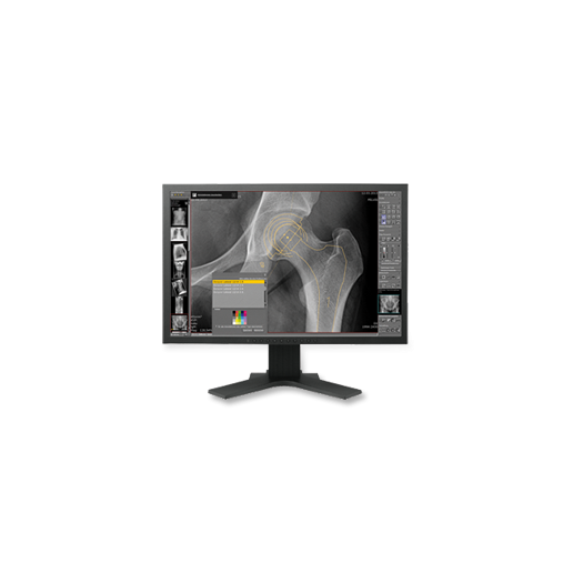 dicomPACS® Prosthesis Documentation Module