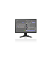 X-ray acquisition software