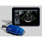 Kosmos Ultraportable Ultrasound System