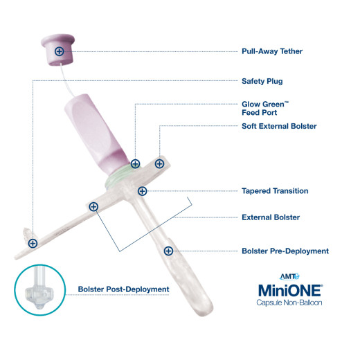 MiniONE® Capsule Non-Balloon Button